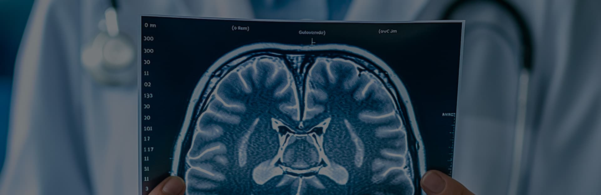뇌졸중 재활치료